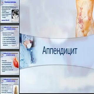 Сколько держится аппендицит