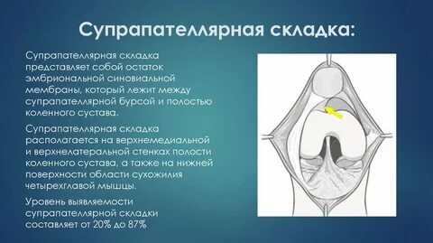 Складки коленного сустава