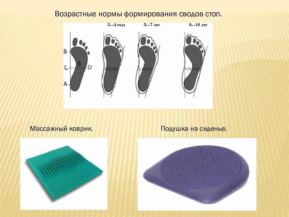 Как вылечить плоскостопие у взрослых. Паралитическое плоскостопие. свод стопы плоскостопие. свод стопы норма и плоскостопие. плоскостопие презентация.
