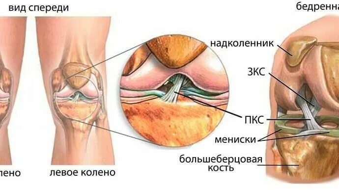 Артроскопическая пластика ПКС коленного сустава. Задняя крестообразная связка коленного сустава анатомия. Пластика связок коленного сустава. Операция на крестообразной связки коленного сустава.