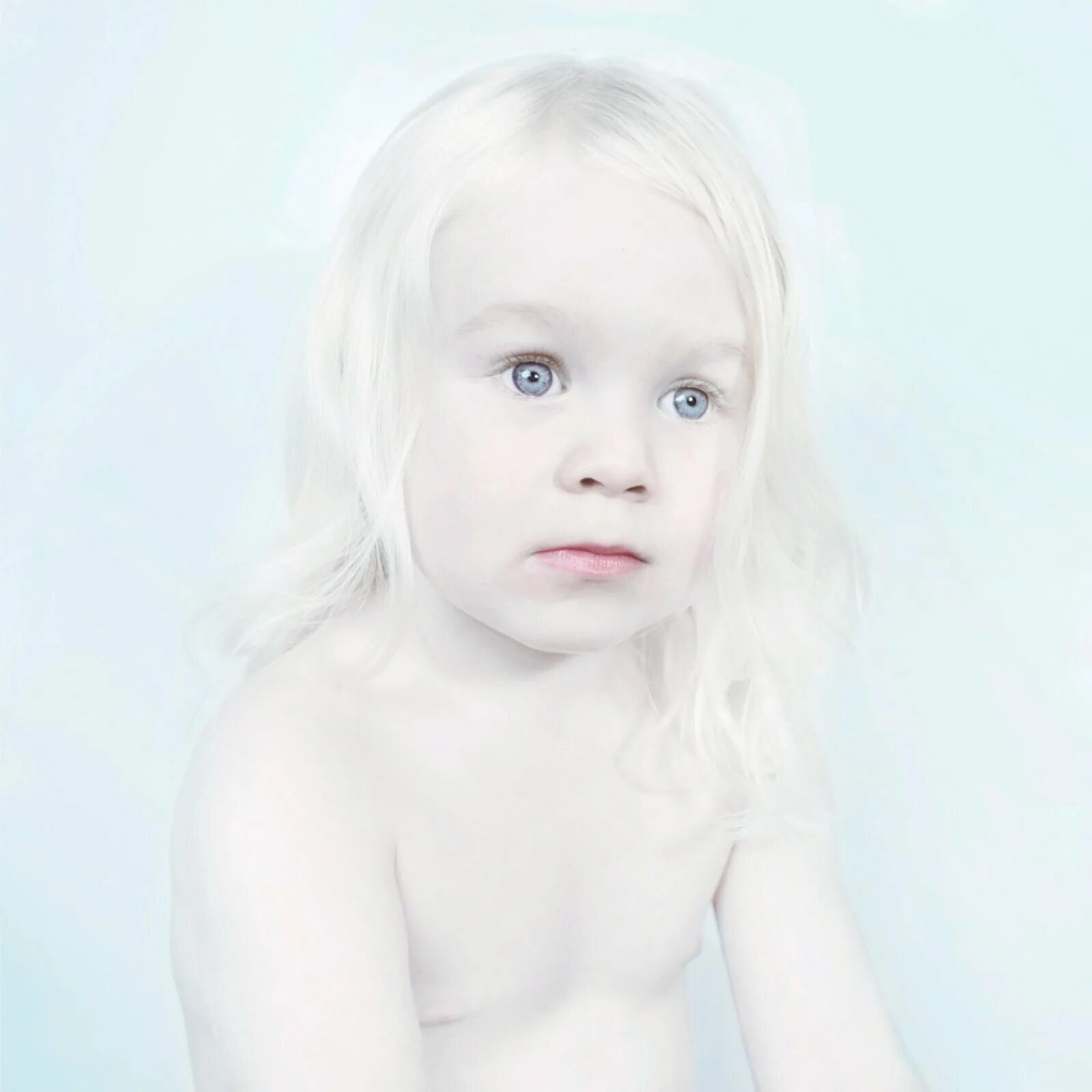 Гипертонус новорожденного. Бледная кожа у ребенка причины. Лысая девочка маленькая. Дети с белыми волосами. Младенец альбинос.