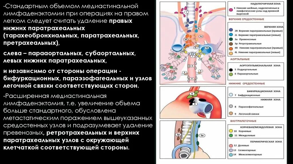 Метастазы при раке щитовидной железы