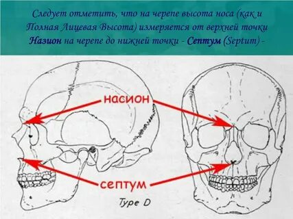 Точки черепа