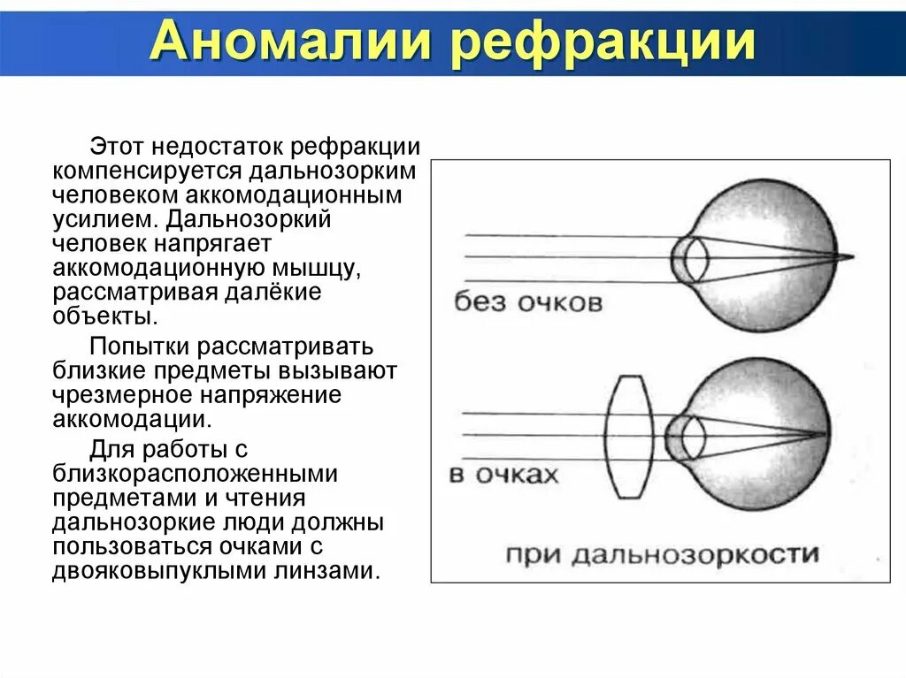 Аккомодация для дали. Аномалии рефракции и аккомодации. Понятие о рефракции и аккомодации. Аномалии рефракции глаза. . Оптическая система глаза. Аккомодация. Аномалии рефракции..