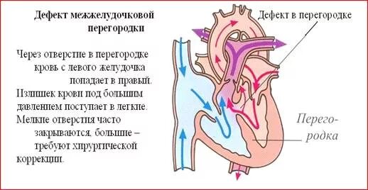 Гемодинамика у детей