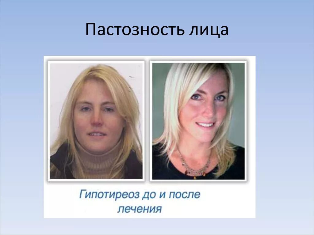 Лекарственные препараты для лечения и профилактики заболеваний щитовидной железы