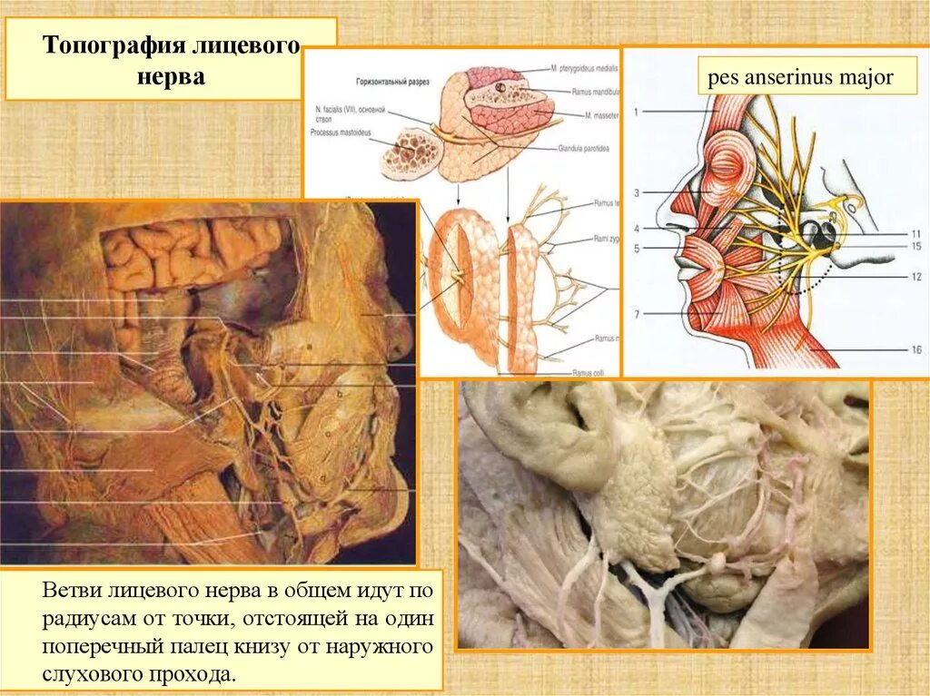 Лицевой черепно мозговой нерв. Лицевой нерв (промежуточно-лицевой нерв VII пара). Внечерепной отдел лицевого нерва. Черепно лицевые нервы анатомия.