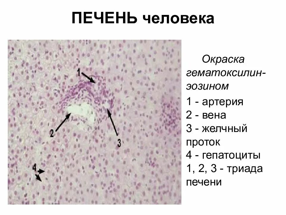 Триада печени. Триада печени гистология препарат. Печень человека окраска гематоксилин-эозином. Междольковая Триада печени гистология. Протоки печени гистология.