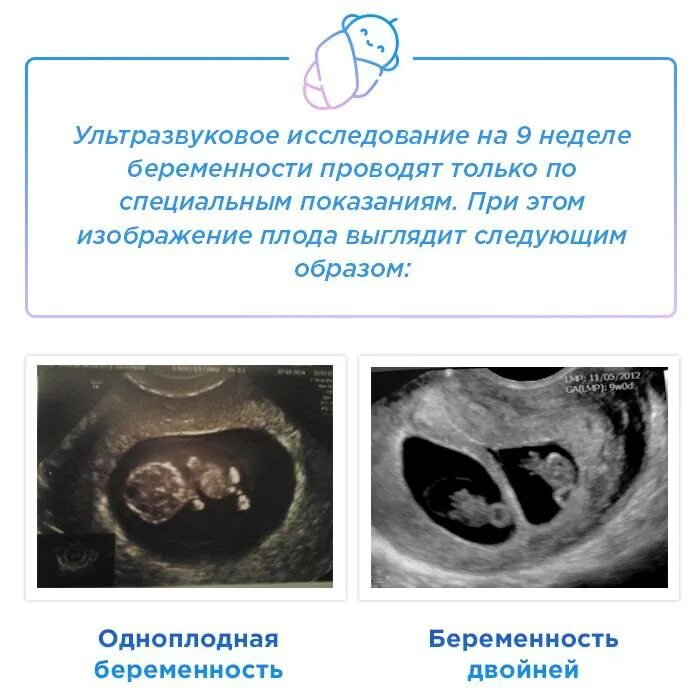 2 9 беременности. УЗИ на 9 акушерской неделе беременности. 9 Неделя акушерский срок беременности УЗИ. Эмбрион 8-9 недель размер плода. УЗИ 9 недель беременности описание.