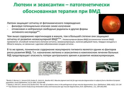 Дегенерация макулы и заднего полюса что это