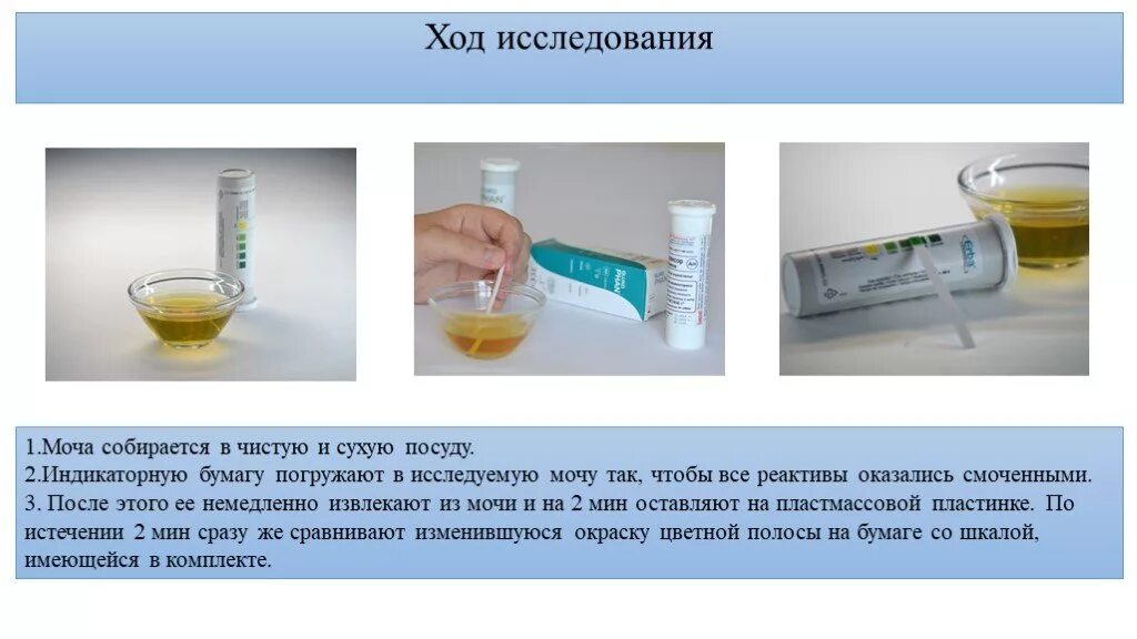 Определение Глюкозы в моче. Определение белка в моче экспресс методом. Метод определения Глюкозы в моче. Выявление Глюкозы в моче.