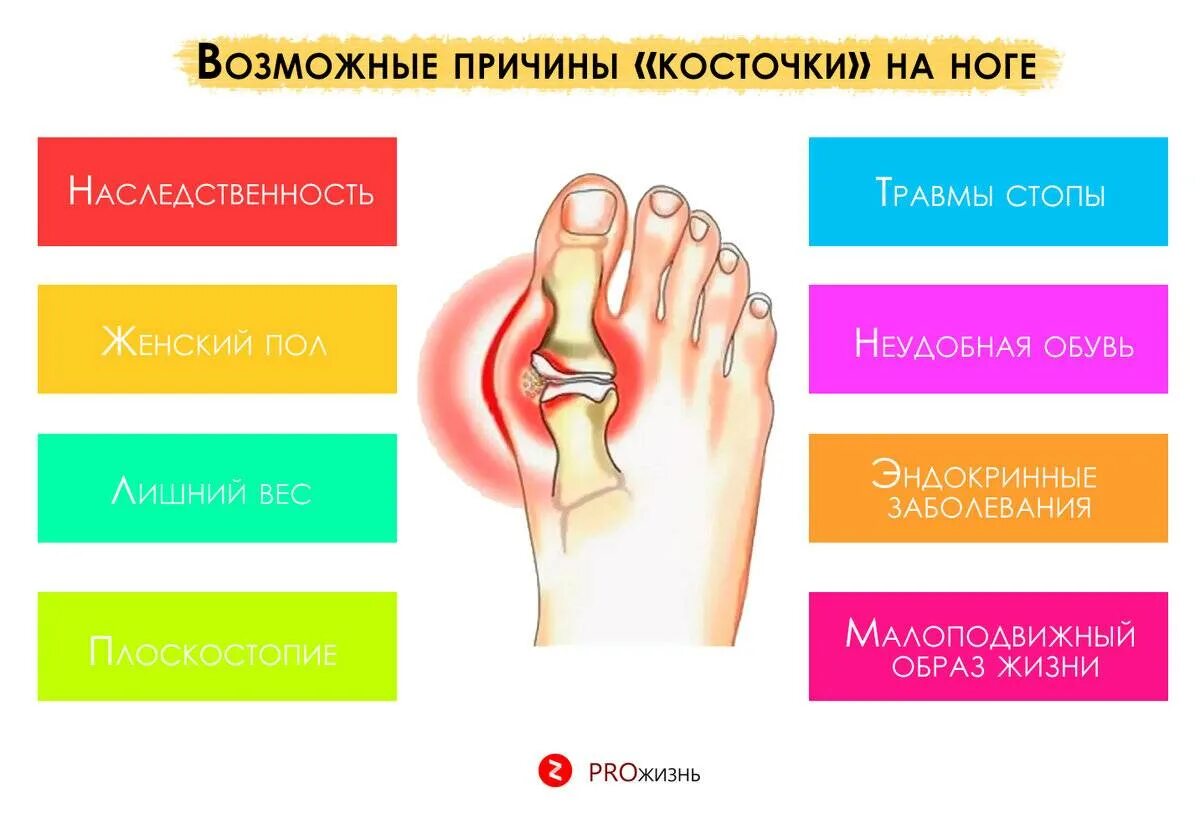 Косточка на ноге к какому врачу обратиться. Косточки на ногах причины возникновения. Косточка на стопе причины. Косточка на ногах причины появления.