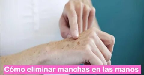 Las manchas