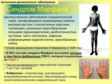 Аутосомно доминантная поликистозная болезнь