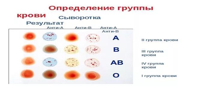 Группа крови. 1 Группа крови. Первая положительная группа крови. Группа крови 1 полодительна. Группа крови д 1