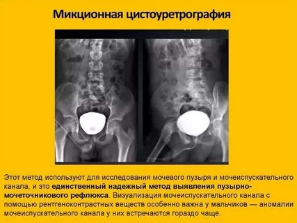 Исследование мочеиспускания