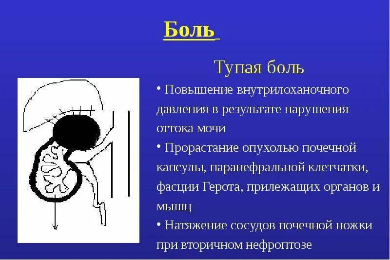 Опухоли почек презентация. Боль при опухоли почки. Опухоль почек у женщин