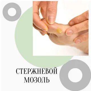 Мазь от стержневых мозолей