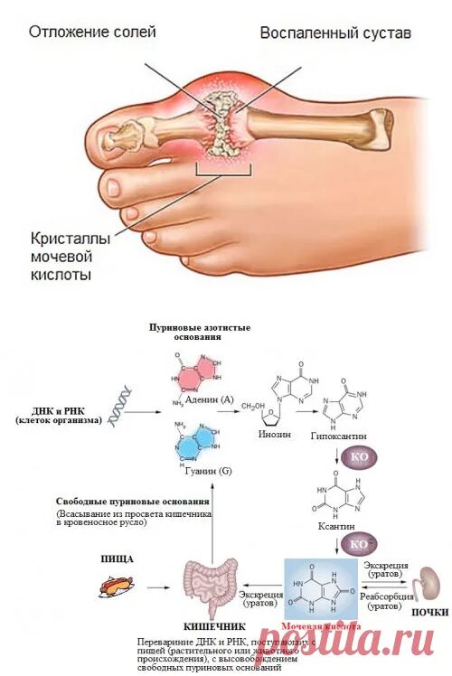 Повышена мочевая кислота к какому врачу обратиться. Секреция мочевой кислоты почками. Вывод мочевой кислоты из организма. Экскреция мочевой кислоты. Выведению солей мочевой кислоты.