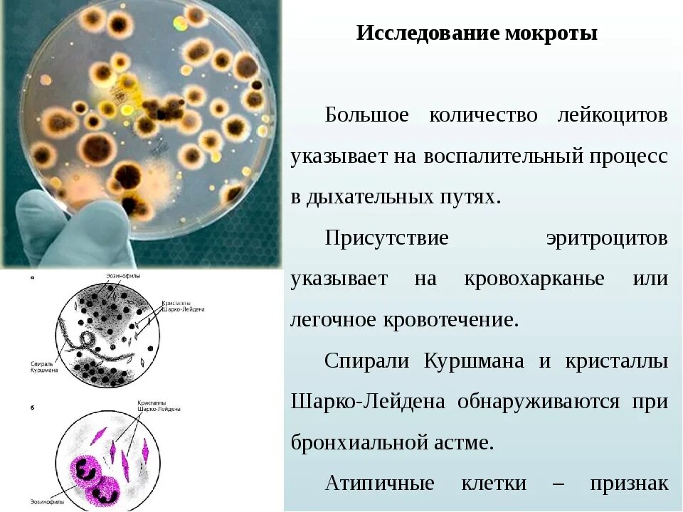 Повышенные лейкоциты в слизи. Анализ мокроты эозинофилы. Микроскопическое исследование мокроты. Цитологическое исследование мокроты.