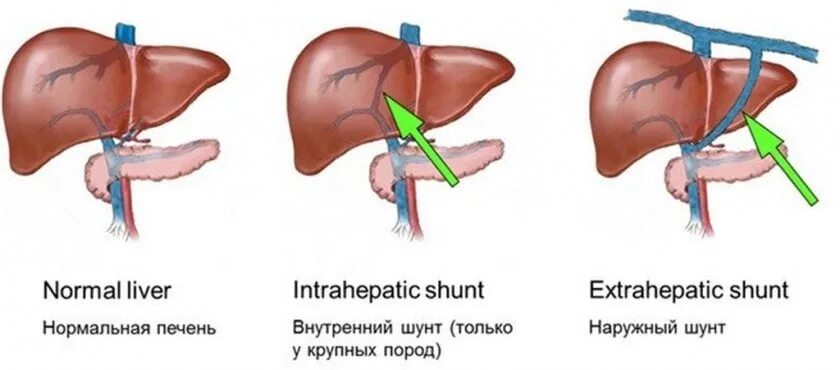 Печень портокавальный шунт. Портосистемный шунт в печени собаки симптомы. Портокавальный шунт у собак. Шунтирование воротной вены печени.