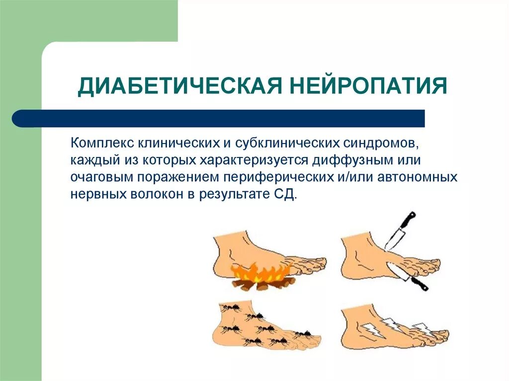 Диабетическая полинейропатия нижних конечностей сенсорная форма. Диабетическая периферическая полинейропатия симптомы. Диабетическая нейропатия нижних конечностей симптомы. Полинейропатия нижних конечностей симптомы при диабете 2 типа. Нейропатия нижних конечностей ног