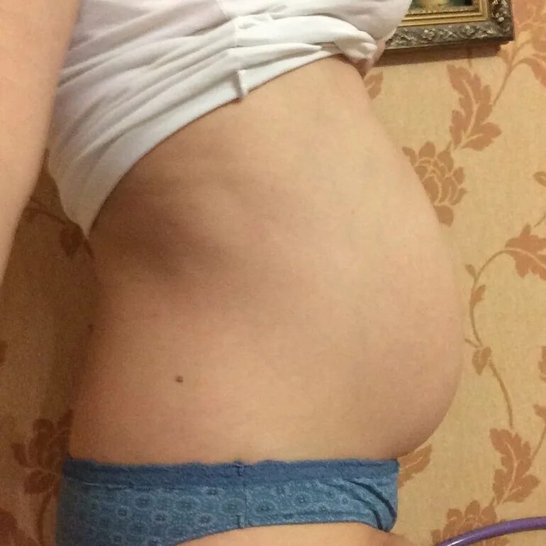 Живот на 12 недель береме. Живот на 14 акушерской неделе беременности. Живот на 12-13 неделе беременности. Живот на 10 неделе. Животики беременных на 12 неделе.