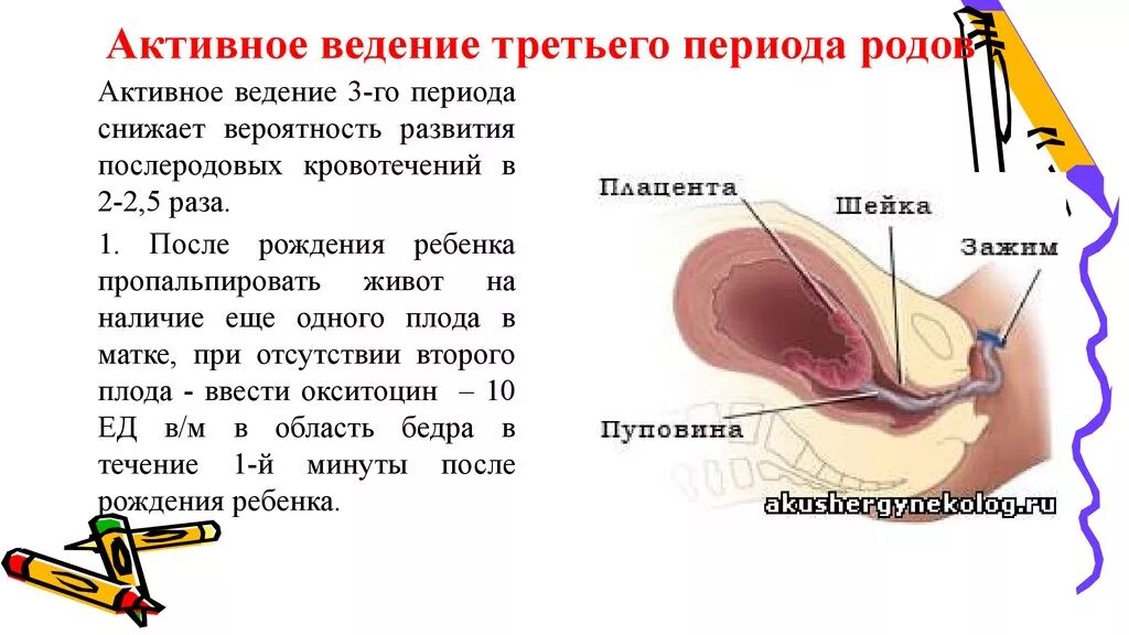 Правило 3 1 1 в родах. Третий период родов Акушерство. Активное ведение III периода родов. Периоды родов ведение родов. Течение и ведение третьего периода родов.