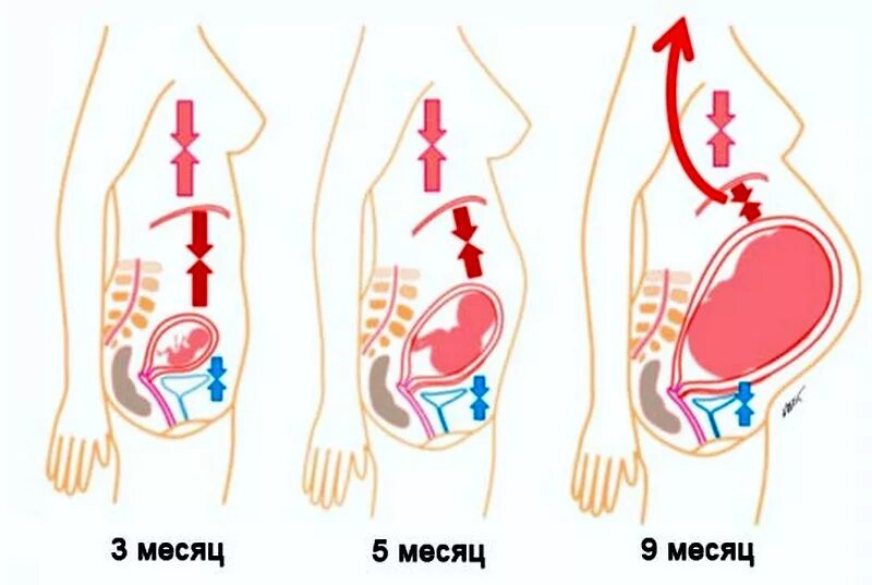 Почему у беременной сильно. Органы при беременности в 3 триместре. Изжога при беременности. Расположение органов у беременных. Расположение органов у беременной женщины 3 триместр.
