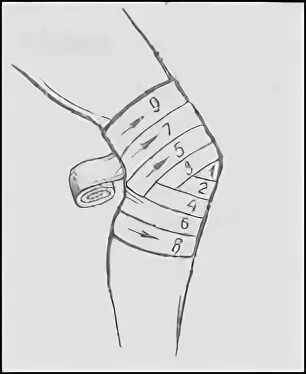Как перевязывать колено. Бинтование колена эластичным бинтом. Бинтование коленного сустава. Бинтование коленного сустава эластичным бинтом. Забинтовать колено эластичным бинтом.