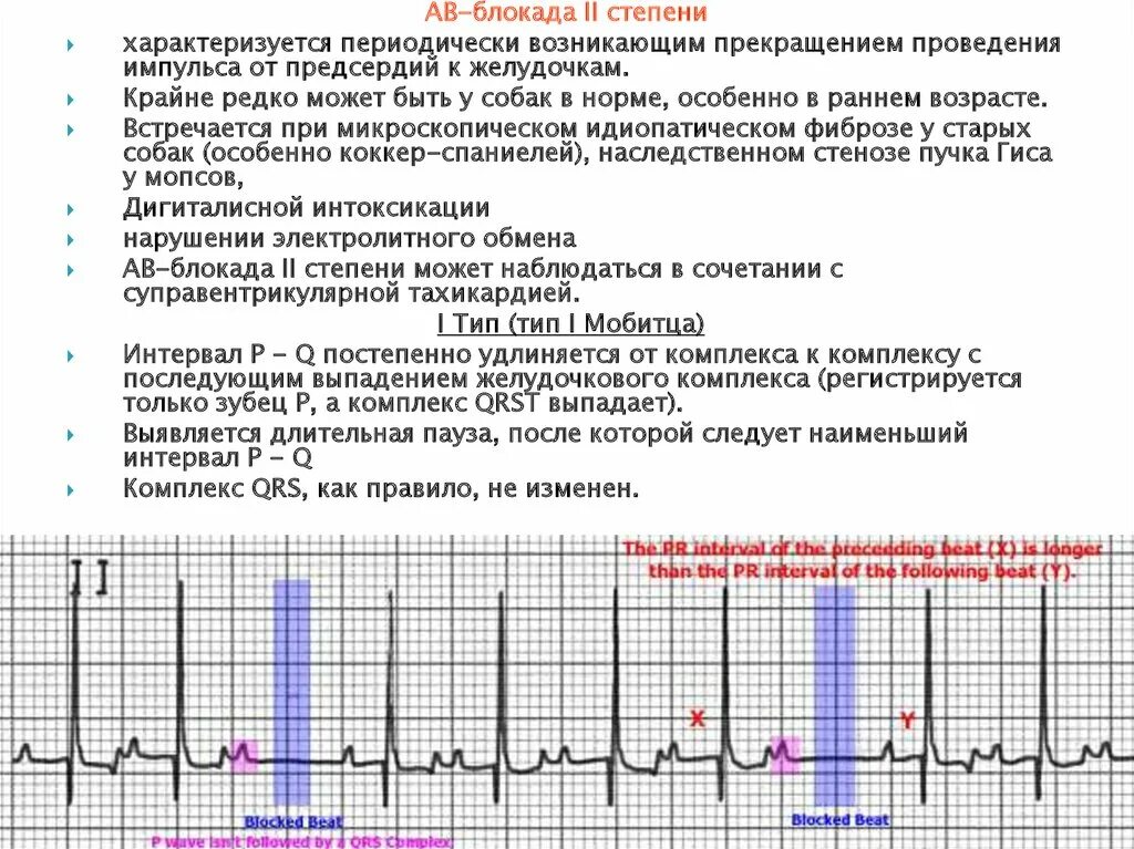 Блокады 2 степени армия. АВ блокада 2 степени характеризуется. ЧСС при АВ блокаде 1 степени. Механизм АВ блокады 2 степени. ЧСС при АВ блокаде 2 степени.