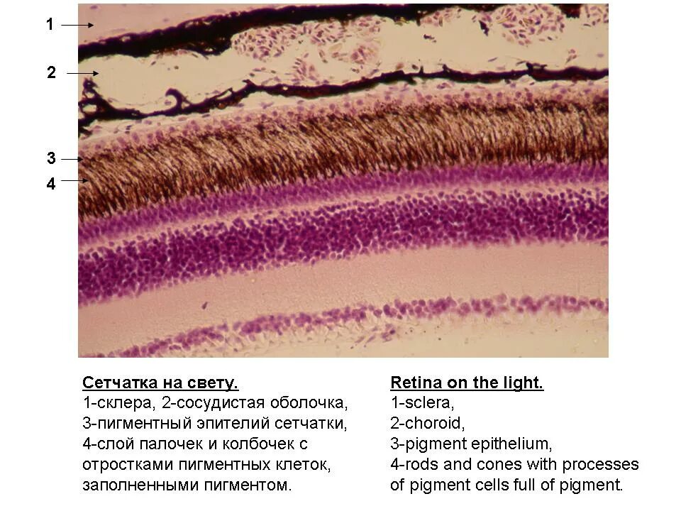 Пигментные клетки гистология препарат. Сетчатка гистология препарат. Сетчатка глаза гистология препарат. Задняя стенка сетчатки глаза гистология.