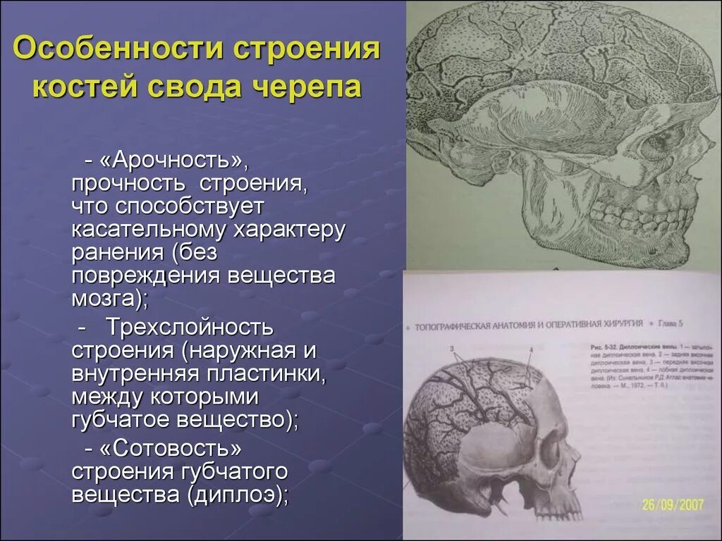 Диплоэ костей свода черепа. Диплоические вены костей свода черепа. Особенности строения костей свода черепа. Строение кости сводла Чрепа.