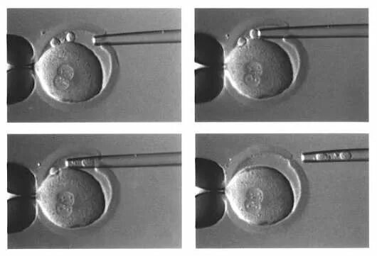 Подсадили эмбрион форум. Биопсия трофэктодермы эмбриона. Подсадка 2 эмбрионов при ИКСИ. Преимплантационная генетическая диагностика эмбрионов. ПГД эмбриона.