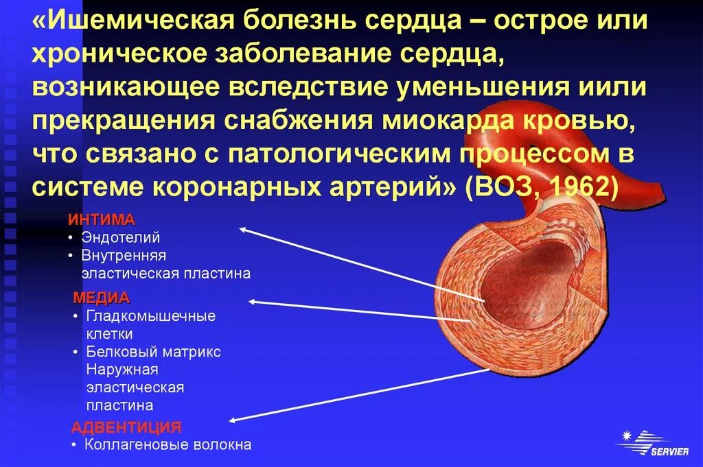 Хроническая ишемия миокарда. Ишемическая болезнь сердца (ИБС). Как проявляется ишемия