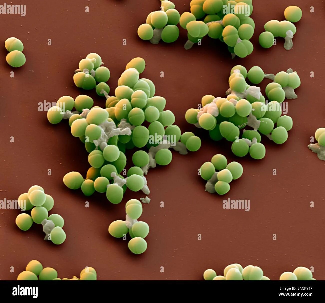 Enterococcus l3. Энтерококк фэциум. энтерококк фекальный (enterococcus faecalis). стрептококки энтерококки. энтерококки микроскопия.