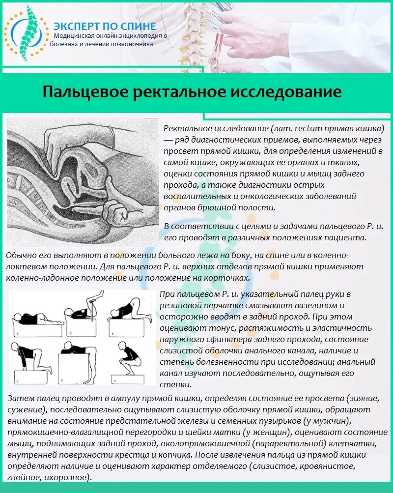 Пальцевое обследование прямой кишки алгоритм. Пальцевое ректальное исследование. Пальцевое ректальное исследование предстательной железы. Палцевое исследованиепрямой кишки.