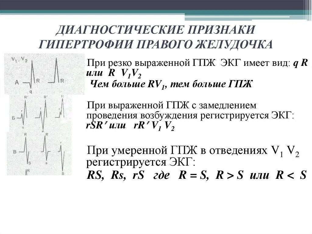 Глж на экг что это значит. ЭКГ критерии гипертрофии правого желудочка. ЭКГ гипертрофия пж на ЭКГ. К ЭКГ признакам гипертрофии правого желудочка относится:. Признак гипертрофии правого желудочка симптомы.