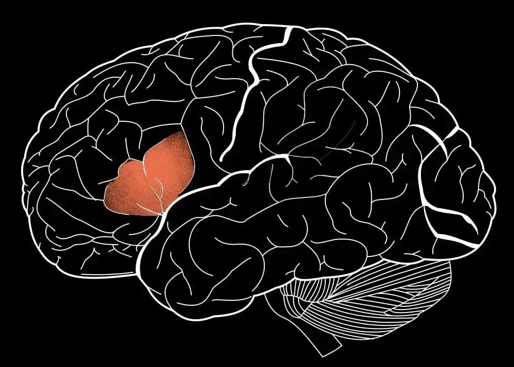 Speech brain