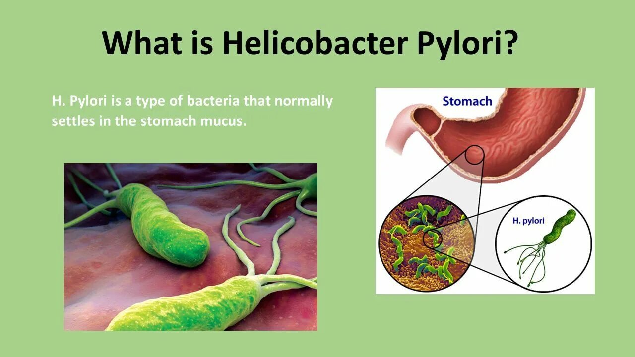 Инфицированность хеликобактер. Helicobacter pylori h pylori. Helicobacter pylori h pylori. Хеликобактер в микроскопе. Бактерия хеликобактер пилори в желудке.
