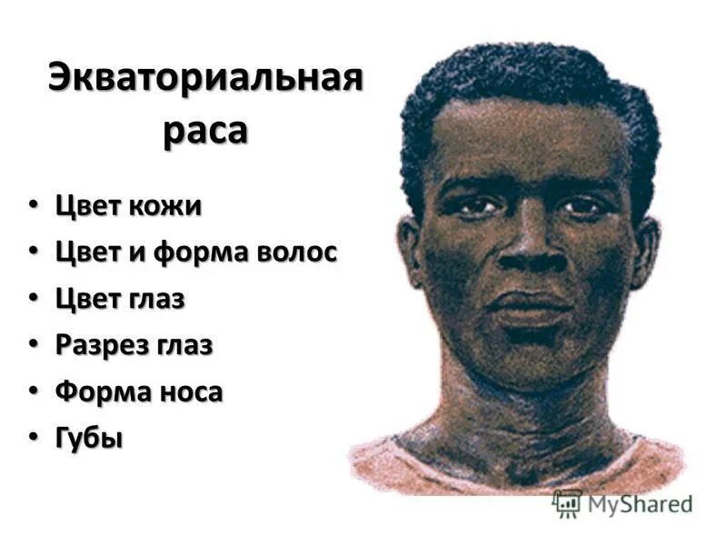 Разрез у негроидной расы