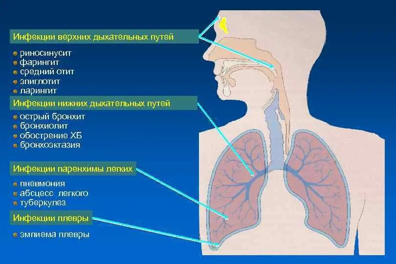 Тест заболевания верхних дыхательных путей. Заболевания дыхательных путей. Заболевания верхних дыхательных путей. Заболевания нижних дыхательных путей. Забрлевнтч верхних двхатнльных пцтеы.