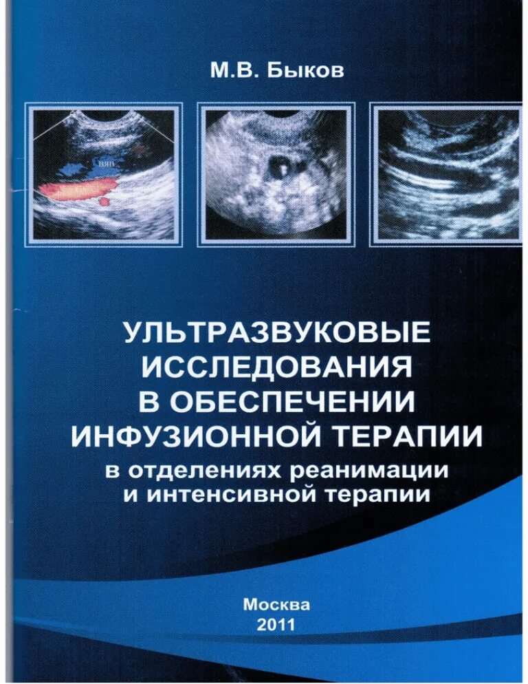 Ультразвуковые исследования в интенсивной терапии. Книги по УЗИ. Книги медицинские по УЗИ. УЗИ В интенсивной терапии и анестезиологии. Ультразвуковая диагностика книги