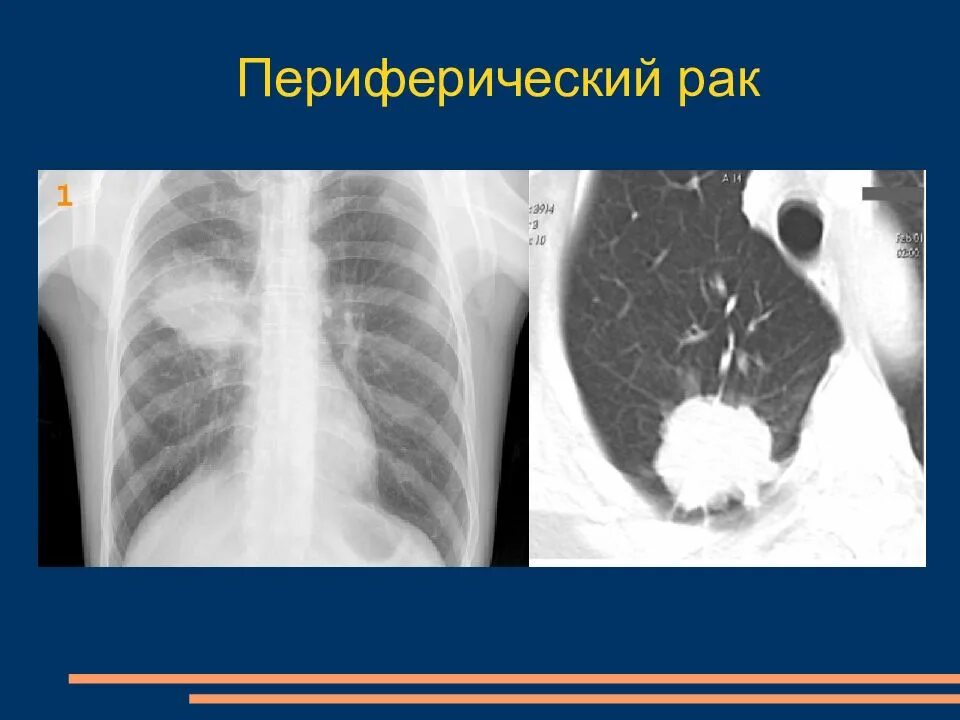 Заболевания грудной полости. Заболеваний органов грудной полости. Патология органов грудной полости. Лучевая диагностика органов грудной клетки. Книга лучевая диагностика заболеваний органов грудной полости.