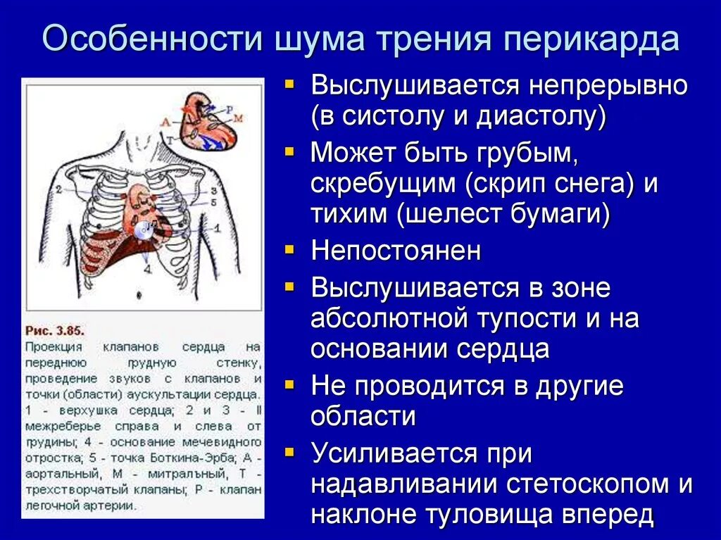 Шум трения плевры усиливается при. Шум начал усиливаться тип. Шум в голове причины. Общее усиление (gain). Диастолический шум на верхушке.