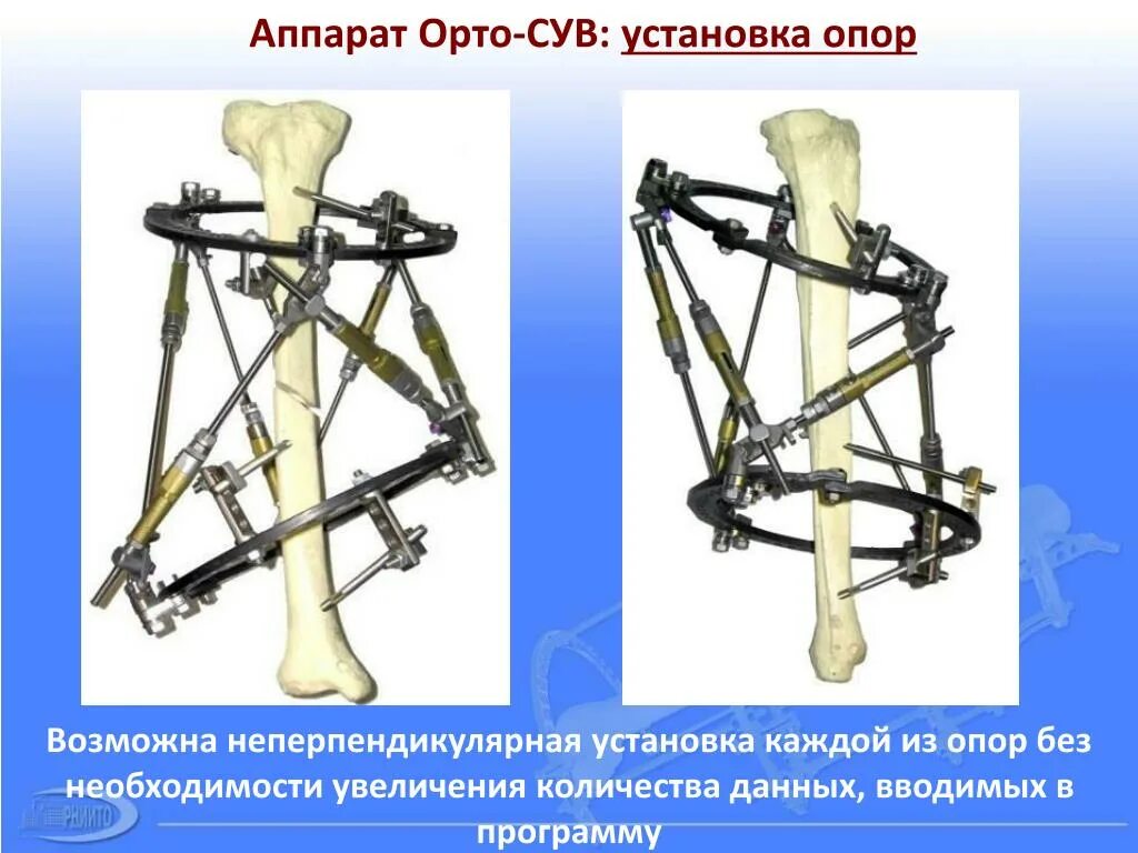 Установки каждая из которых. Установки каждая из которых