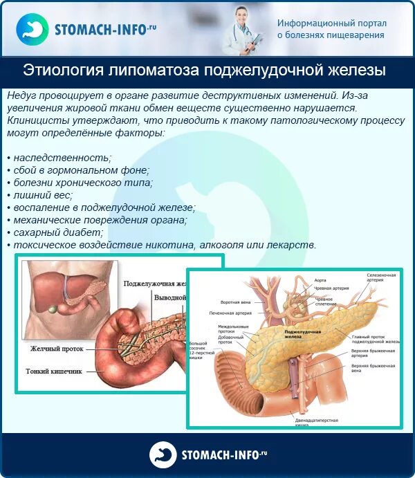 Структурные изменения поджелудочной железы. Липоматоз поджелудочной железы на УЗИ. Панкреатит липоматоз поджелудочной железы. Липоматоз поджелудочной железы диета. Питание при липоматозе поджелудочной железы.