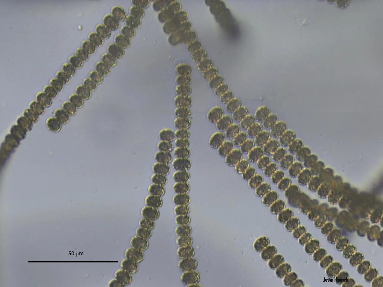 Анабена. Цианобактерия анабена. цианобактерии афанизоменон. anabaena sp. anabaena водоросль.