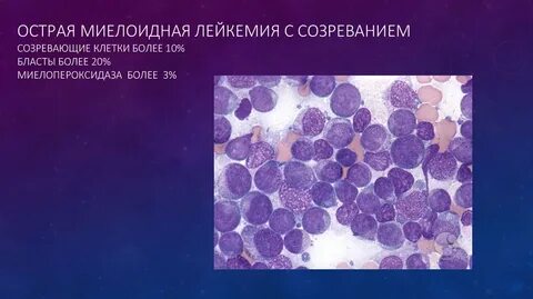Острые миелоидные лейкозы по утвержденным клиническим