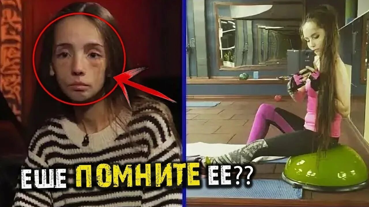 Катя девушка с анорексией из битвы экстрасенсов. Анорексичка из битвы экстрасенсов.
